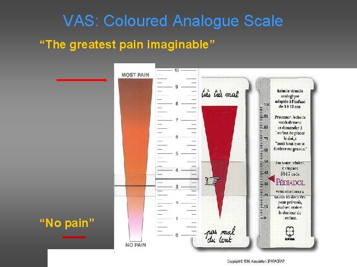 VAS: Coloured Analogue Scale “The greatest pain imaginable” “No pain” 