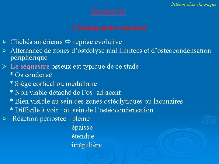 Imagerie Ostéomyélite chronique 1/Radiographie standard Clichés antérieurs reprise évolutive Alternance de zones d’ostéolyse mal