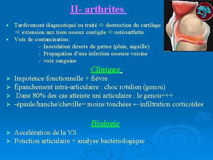 II- arthrites Tardivement diagnostiqué ou traité destruction du cartilage extension aux tissu osseux contigüe