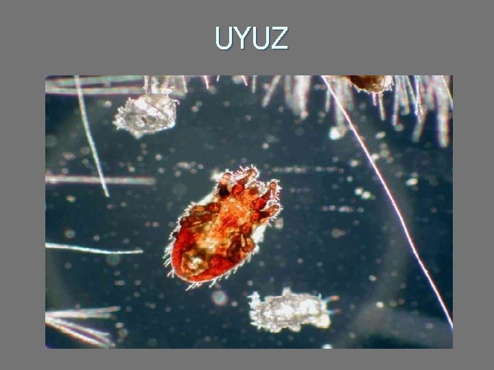 UYUZ 