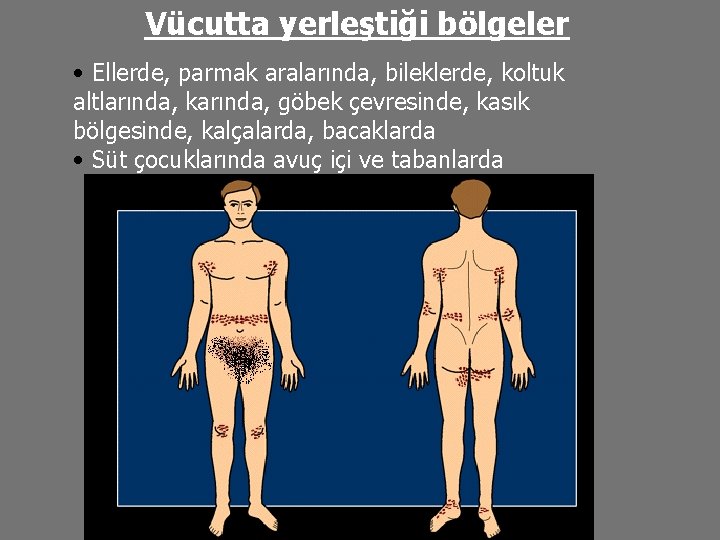 Vücutta yerleştiği bölgeler • Ellerde, parmak aralarında, bileklerde, koltuk altlarında, karında, göbek çevresinde, kasık