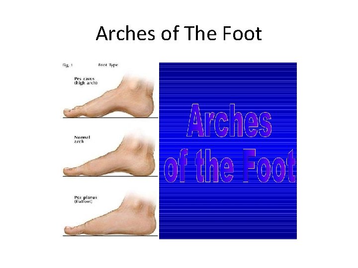 Arches of The Foot 
