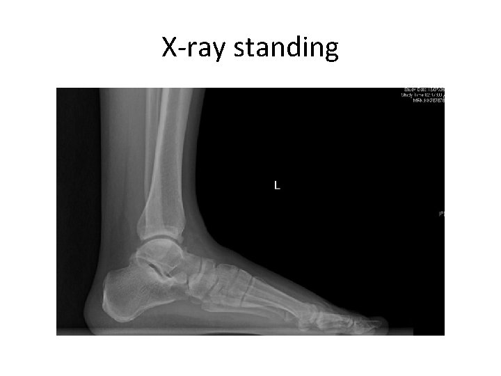 X-ray standing 