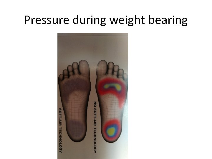 Pressure during weight bearing 