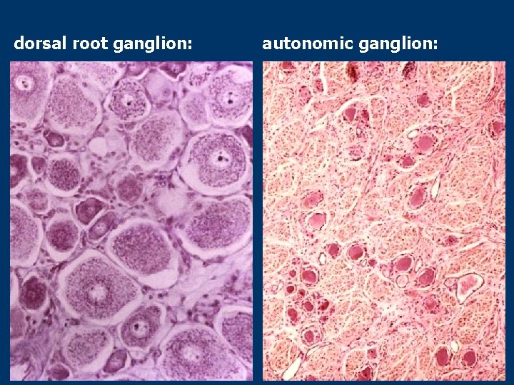 dorsal root ganglion: autonomic ganglion: 