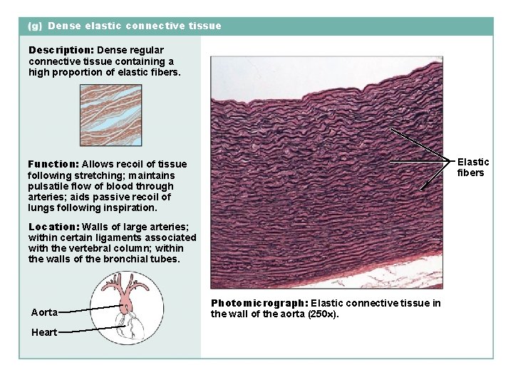 Dense elastic connective tissue Description: Dense regular connective tissue containing a high proportion of