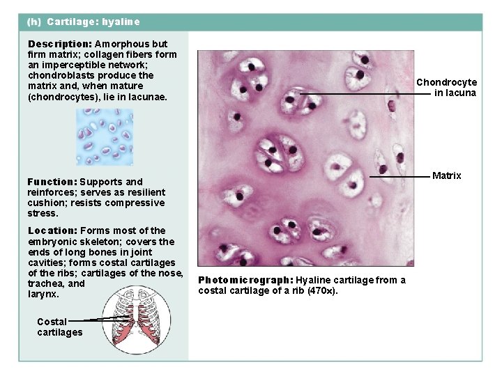 Cartilage: hyaline Description: Amorphous but firm matrix; collagen fibers form an imperceptible network; chondroblasts