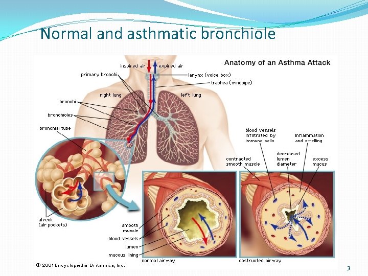 Normal and asthmatic bronchiole 3 