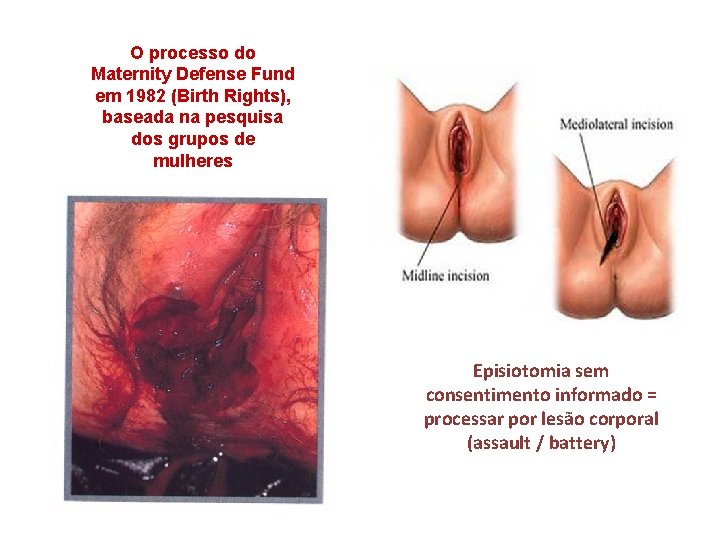 O processo do Maternity Defense Fund em 1982 (Birth Rights), baseada na pesquisa dos