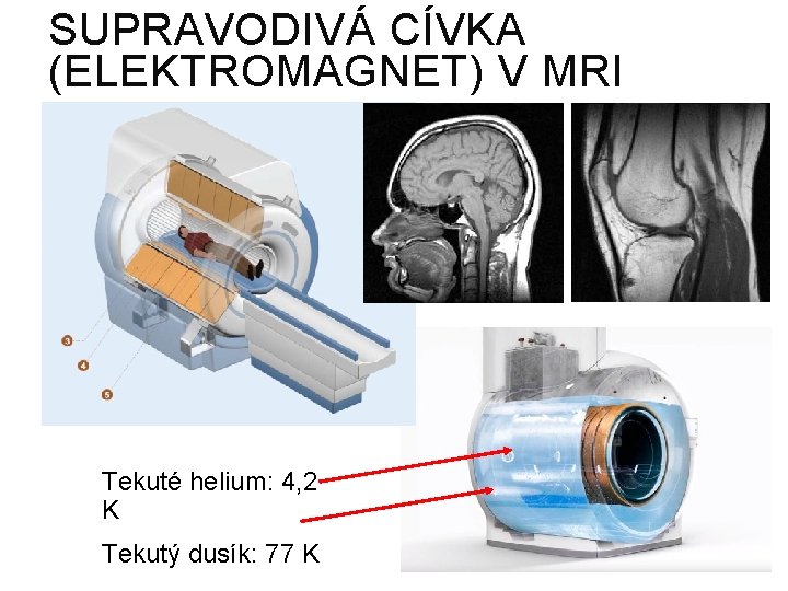 SUPRAVODIVÁ CÍVKA (ELEKTROMAGNET) V MRI Tekuté helium: 4, 2 K Tekutý dusík: 77 K