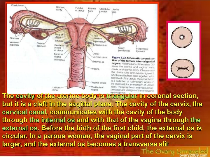 The cavity of the uterine body is triangular in coronal section, but it is