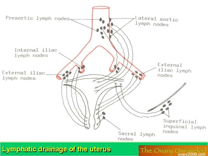 Lymphatic drainage of the uterus 