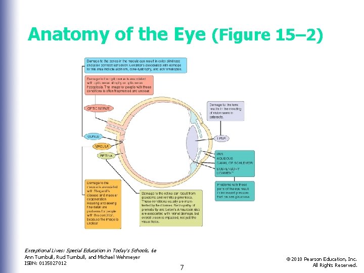 Anatomy of the Eye (Figure 15– 2) Exceptional Lives: Special Education in Today’s Schools,