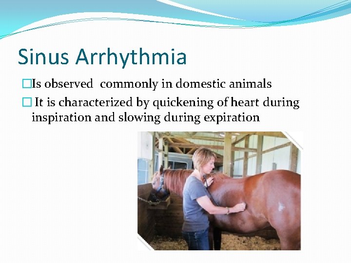 Sinus Arrhythmia �Is observed commonly in domestic animals � It is characterized by quickening