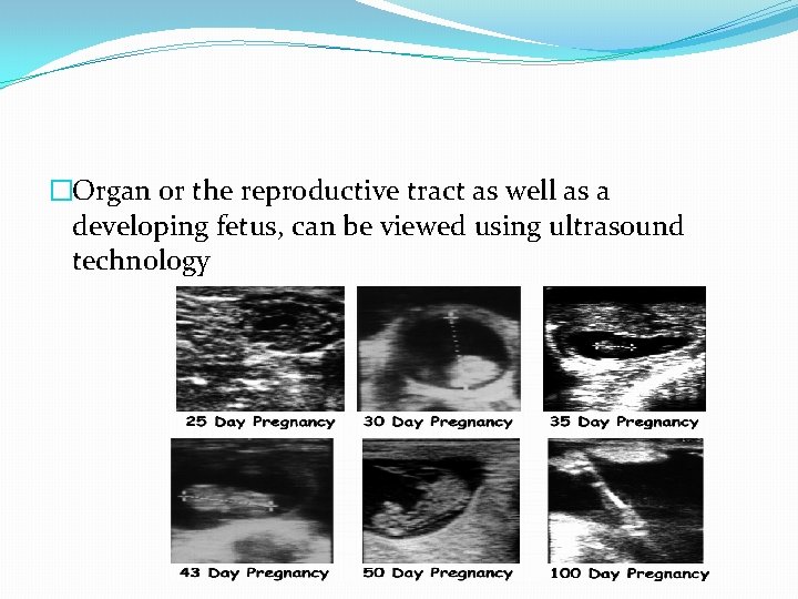 �Organ or the reproductive tract as well as a developing fetus, can be viewed