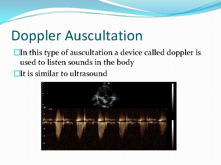 Doppler Auscultation �In this type of auscultation a device called doppler is used to