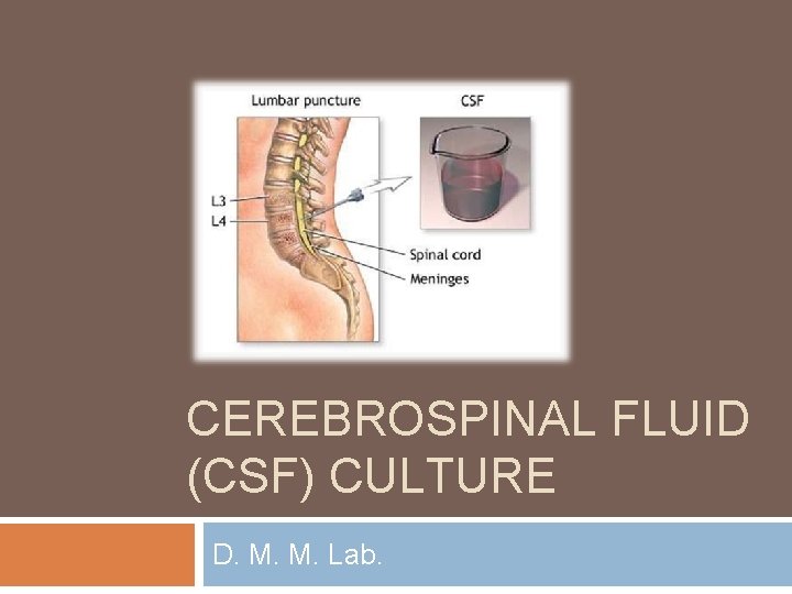 CEREBROSPINAL FLUID (CSF) CULTURE D. M. M. Lab. 