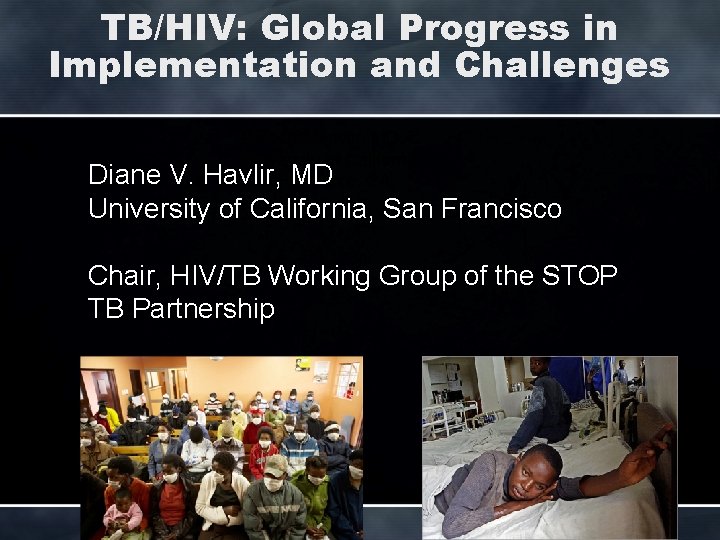 TB/HIV: Global Progress in Implementation and Challenges Diane V. Havlir, MD University of California,
