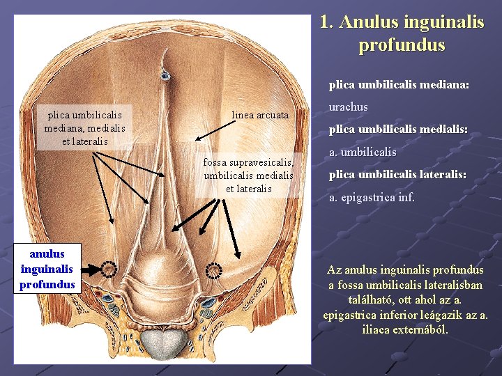 1. Anulus inguinalis profundus plica umbilicalis mediana: plica umbilicalis mediana, medialis et lateralis linea