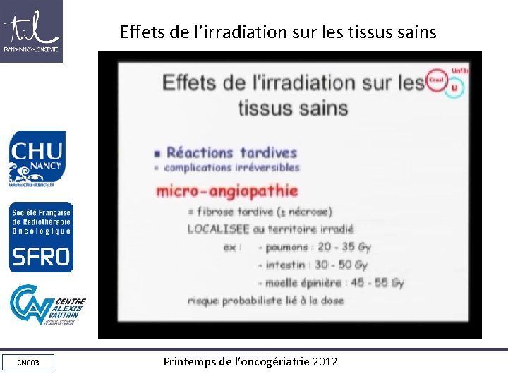 Effets de l’irradiation sur les tissus sains • Réactions tardives • Complication irréversibles micro-ongiopathie