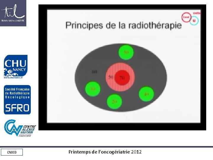 Principes de la radiothérapie CN 003 Printemps de l’oncogériatrie 2012 