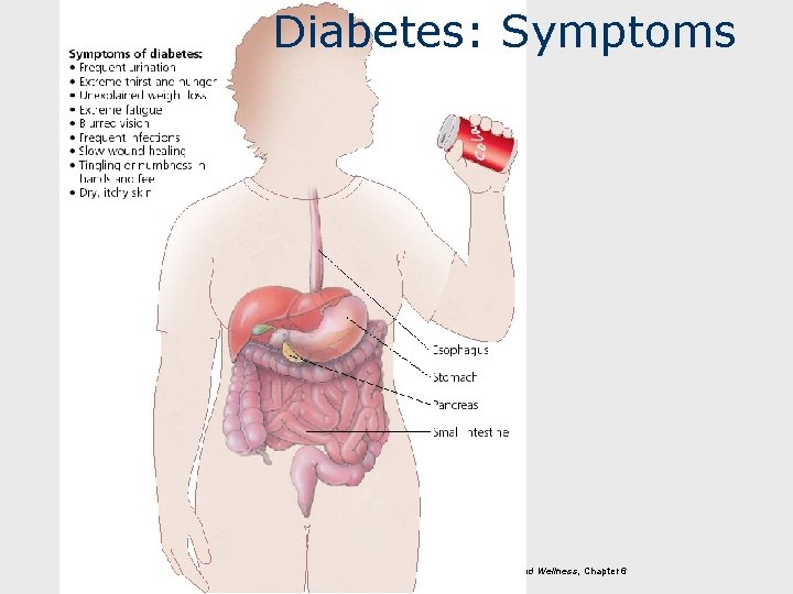 Diabetes: Symptoms Fahey/Insel/Roth, Fit & Well: Core Concepts and Labs in Physical Fitness and