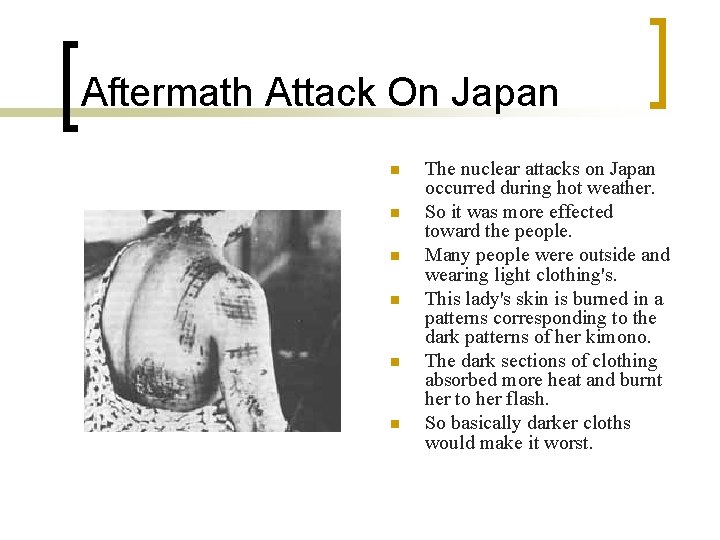 Aftermath Attack On Japan n n n The nuclear attacks on Japan occurred during