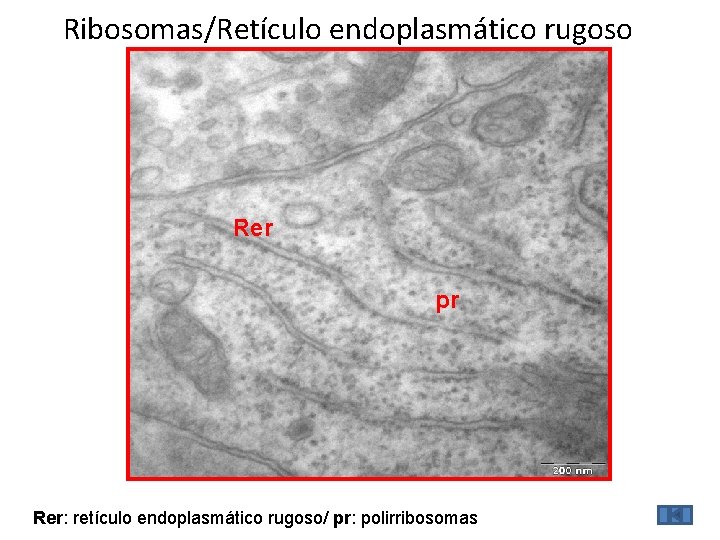 Ribosomas/Retículo endoplasmático rugoso Rer pr Rer: retículo endoplasmático rugoso/ pr: polirribosomas 