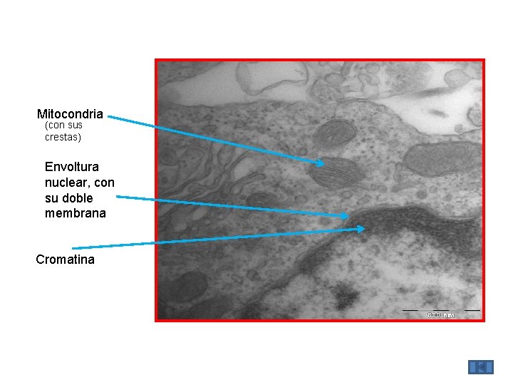 Mitocondria (con sus crestas) Envoltura nuclear, con su doble membrana Cromatina 