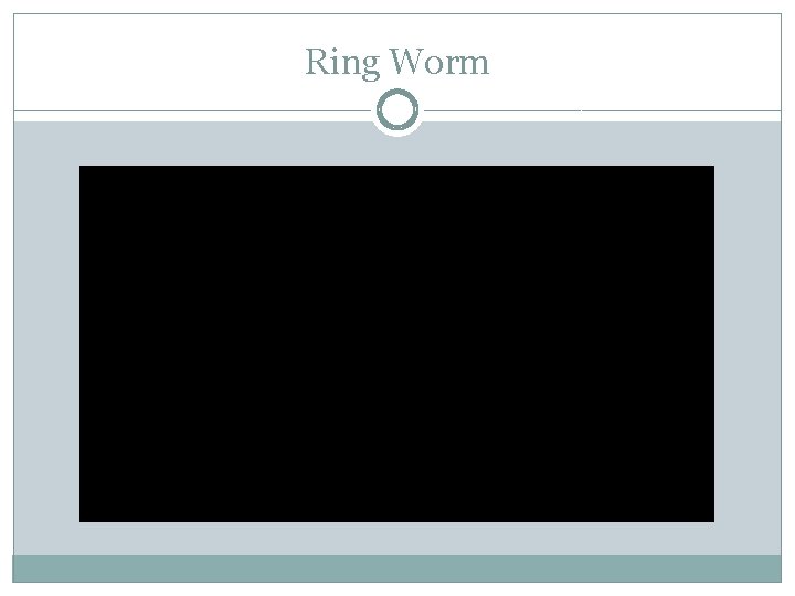 Ring Worm 