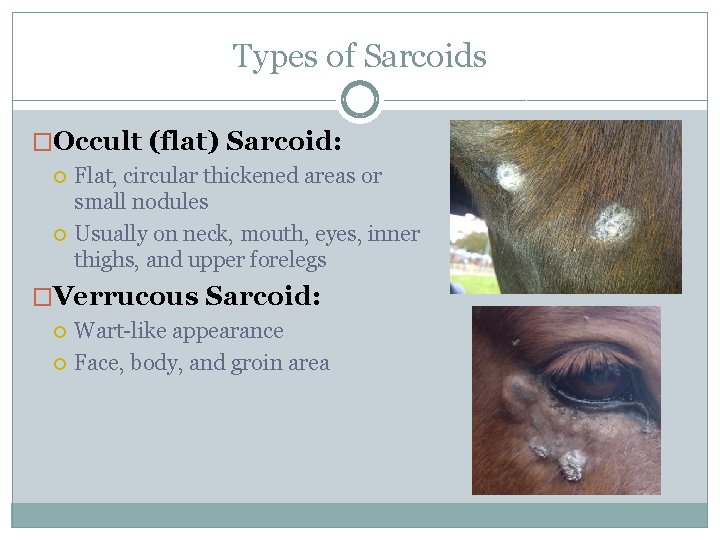 Types of Sarcoids �Occult (flat) Sarcoid: Flat, circular thickened areas or small nodules Usually