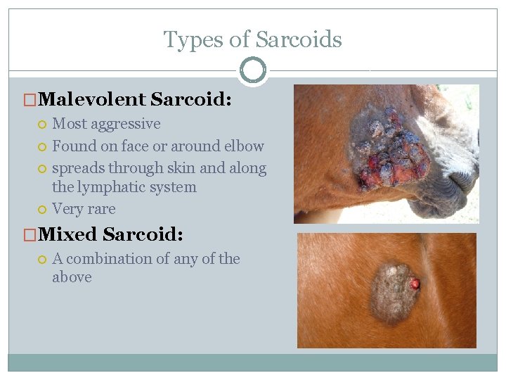 Types of Sarcoids �Malevolent Sarcoid: Most aggressive Found on face or around elbow spreads