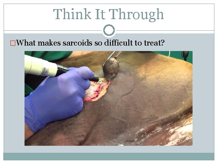 Think It Through �What makes sarcoids so difficult to treat? 