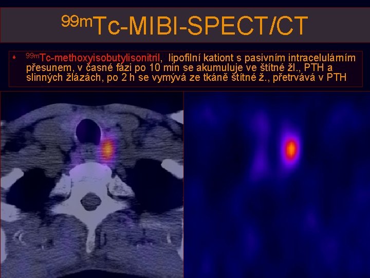 Modern zpsoby zobrazen ndor vpoetn tomografi HYBRIDN ZOBRAZEN