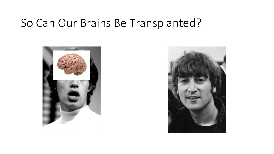 So Can Our Brains Be Transplanted? 