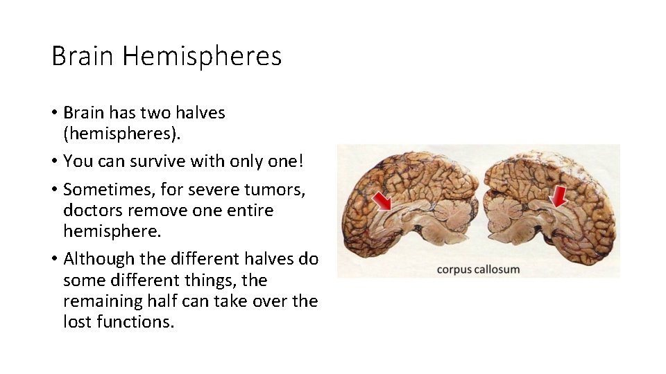 Brain Hemispheres • Brain has two halves (hemispheres). • You can survive with only