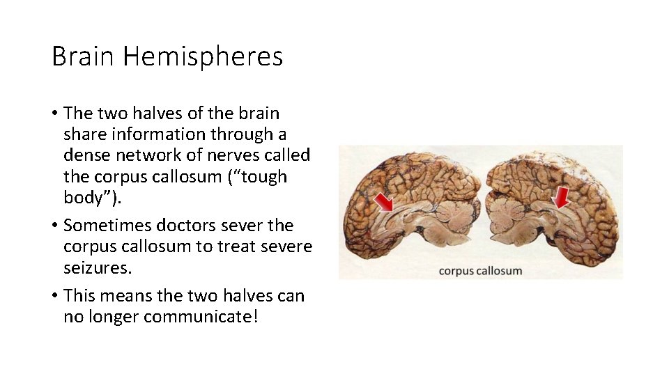 Brain Hemispheres • The two halves of the brain share information through a dense