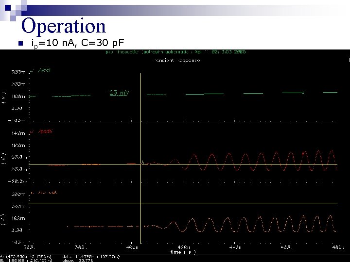 Operation n ip=10 n. A, C=30 p. F 