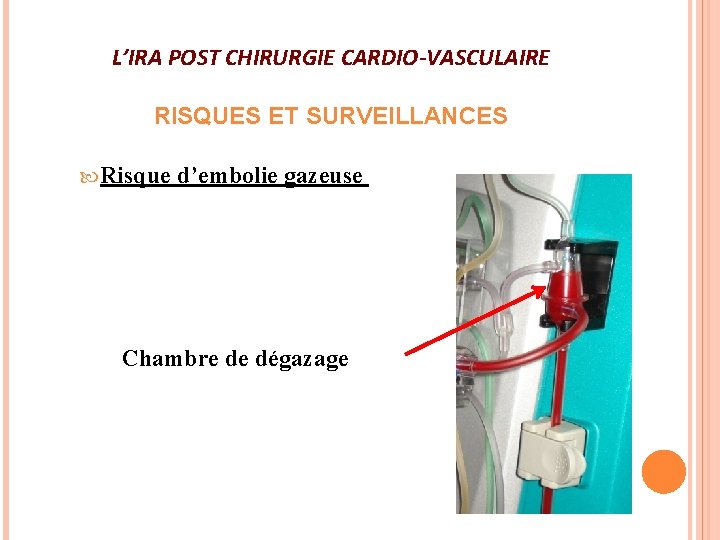 L’IRA POST CHIRURGIE CARDIO-VASCULAIRE RISQUES ET SURVEILLANCES Risque d’embolie gazeuse Chambre de dégazage 