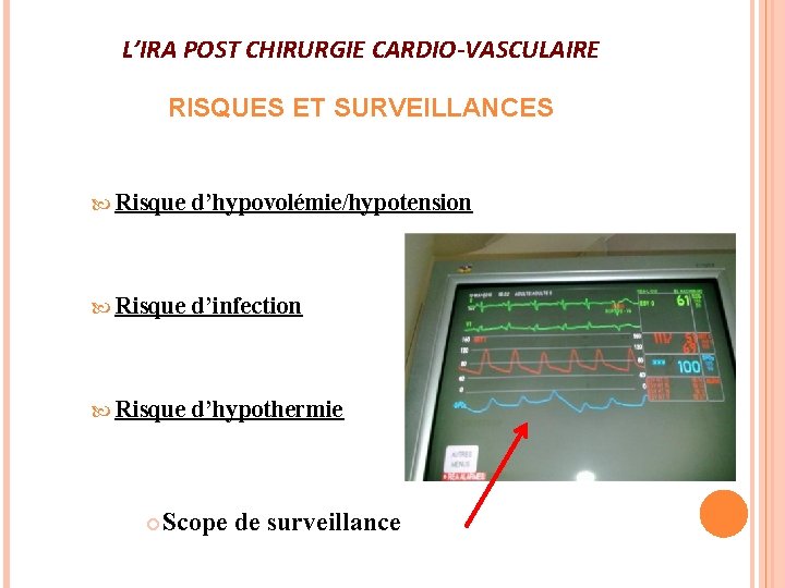 L’IRA POST CHIRURGIE CARDIO-VASCULAIRE RISQUES ET SURVEILLANCES Risque d’hypovolémie/hypotension Risque d’infection Risque d’hypothermie Scope