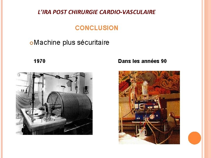 L’IRA POST CHIRURGIE CARDIO-VASCULAIRE CONCLUSION Machine plus sécuritaire 1970 Dans les années 90 