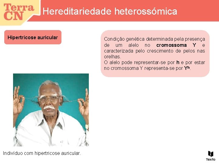 Hereditariedade heterossómica Hipertricose auricular Indivíduo com hipertricose auricular. Condição genética determinada pela presença de