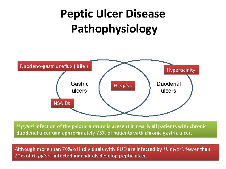Peptic Ulcer Disease Pathophysiology Duodeno-gastric reflux ( bile ) Gastric ulcers Hyperacidity H. pylori