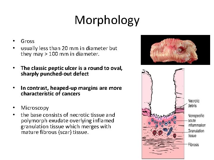 Morphology • Gross • usually less than 20 mm in diameter but they may