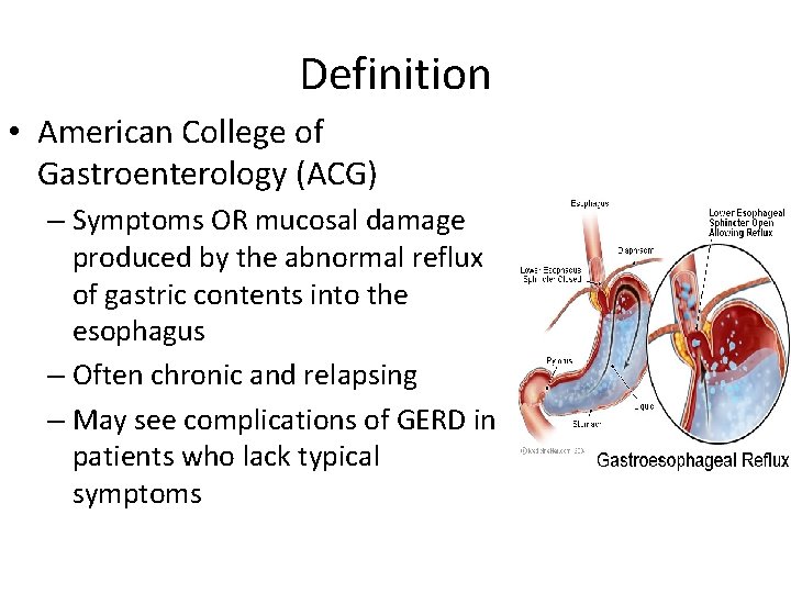 Definition • American College of Gastroenterology (ACG) – Symptoms OR mucosal damage produced by