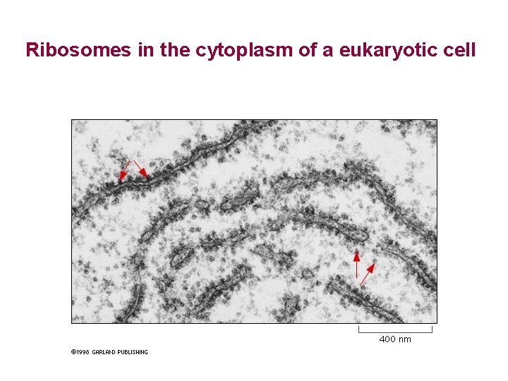 Ribosomes in the cytoplasm of a eukaryotic cell 