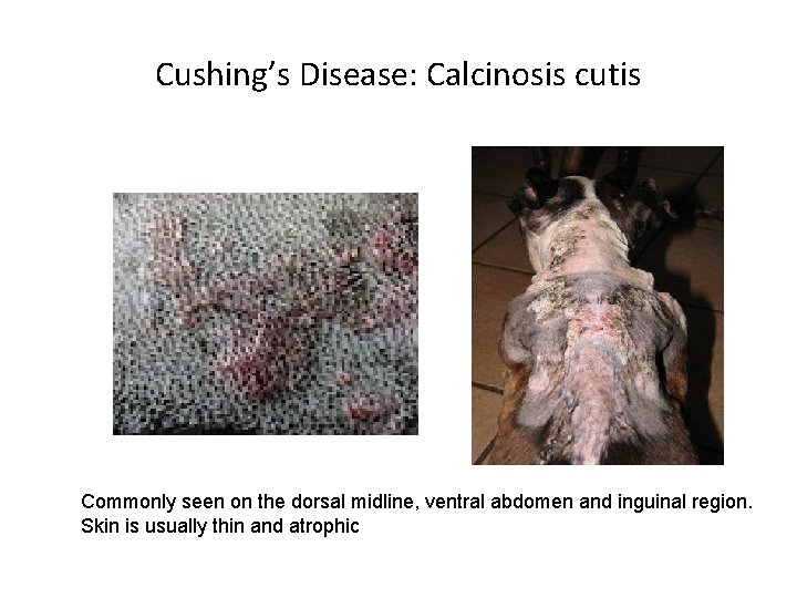 Cushing’s Disease: Calcinosis cutis Commonly seen on the dorsal midline, ventral abdomen and inguinal