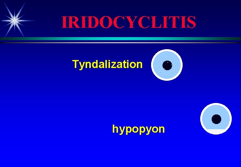 IRIDOCYCLITIS Tyndalization . . . hypopyon 