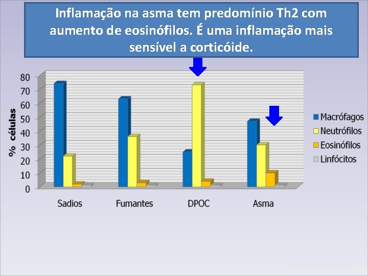 Inflamação na asma tem predomínio Th 2 com aumento de eosinófilos. É uma inflamação