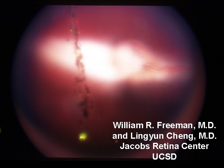William R. Freeman, M. D. and Lingyun Cheng, M. D. Jacobs Retina Center UCSD